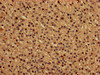 IHC image of CSB-PA01034A0Rb diluted at 1:150 and staining in paraffin-embedded human adrenal gland tissue performed on a Leica BondTM system. After dewaxing and hydration, antigen retrieval was mediated by high pressure in a citrate buffer (pH 6.0) . Section was blocked with 10% normal goat serum 30min at RT. Then primary antibody (1% BSA) was incubated at 4°C overnight. The primary is detected by a biotinylated secondary antibody and visualized using an HRP conjugated SP system.