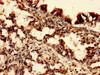 IHC image of CSB-PA01034A0Rb diluted at 1:150 and staining in paraffin-embedded human lung tissue performed on a Leica BondTM system. After dewaxing and hydration, antigen retrieval was mediated by high pressure in a citrate buffer (pH 6.0) . Section was blocked with 10% normal goat serum 30min at RT. Then primary antibody (1% BSA) was incubated at 4°C overnight. The primary is detected by a biotinylated secondary antibody and visualized using an HRP conjugated SP system.