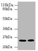 Western blot<br />
 All lanes: HMGCR antibody at 2µg/ml<br />
 Lane 1: Hela whole cell lysate<br />
 Lane 2: 293T whole cell lysate<br />
 Secondary<br />
 Goat polyclonal to rabbit IgG at 1/10000 dilution<br />
 Predicted band size: 98, 93, 100 kDa<br />
 Observed band size: 25 kDa<br />