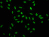 Immunofluorescence staining of Hela cells with CSB-PA010600HA01HU at 1:100, counter-stained with DAPI. The cells were fixed in 4% formaldehyde, permeabilized using 0.2% Triton X-100 and blocked in 10% normal Goat Serum. The cells were then incubated with the antibody overnight at 4°C. The secondary antibody was Alexa Fluor 488-congugated AffiniPure Goat Anti-Rabbit IgG (H+L) .