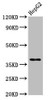 Western Blot<br />
 Positive WB detected in: HepG2 whole cell lysate<br />
 All lanes: HNRNPA1 antibody at 3.9µg/ml<br />
 Secondary<br />
 Goat polyclonal to rabbit IgG at 1/50000 dilution<br />
 Predicted band size: 39, 35, 30 kDa<br />
 Observed band size: 39 kDa<br />
