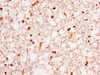 IHC image of CSB-PA010600HA01HU diluted at 1:300 and staining in paraffin-embedded human brain tissue performed on a Leica BondTM system. After dewaxing and hydration, antigen retrieval was mediated by high pressure in a citrate buffer (pH 6.0) . Section was blocked with 10% normal goat serum 30min at RT. Then primary antibody (1% BSA) was incubated at 4°C overnight. The primary is detected by a biotinylated secondary antibody and visualized using an HRP conjugated SP system.
