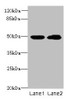 Western blot<br />
 All lanes: HNRNPH1 antibody at 8µg/ml<br />
 Lane 1: HepG2 whole cell lysate<br />
 Lane 2: MCF-7 whole cell lysate<br />
 Secondary<br />
 Goat polyclonal to rabbit IgG at 1/10000 dilution<br />
 Predicted band size: 50 kDa<br />
 Observed band size: 50 kDa<br />