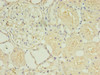 Immunohistochemistry of paraffin-embedded human kidney tissue using CSB-PA010656EA01HU at dilution of 1:100