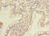 Immunohistochemistry of paraffin-embedded human small intestine tissue using CSB-PA010672LA01HU at dilution of 1:100