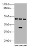 Western blot<br />
 All lanes: HPD antibody at 4.5µg/ml<br />
 Lane 1: Mouse kidney tissue<br />
 Lane 2: Mouse liver tissue<br />
 Lane 3: HepG2 whole cell lysate<br />
 Secondary<br />
 Goat polyclonal to rabbit IgG at 1/10000 dilution<br />
 Predicted band size: 45, 41 kDa<br />
 Observed band size: 45 kDa<br />