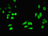 Immunofluorescent analysis of HepG2 cells using CSB-PA010698LA01HU at dilution of 1:100 and Alexa Fluor 488-congugated AffiniPure Goat Anti-Rabbit IgG (H+L)