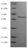 (Tris-Glycine gel) Discontinuous SDS-PAGE (reduced) with 5% enrichment gel and 15% separation gel.