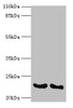 Western blot<br />
 All lanes: IFNA14 antibody at 2µg/ml<br />
 Lane 1: A549 whole cell lysate<br />
 Lane 2: Mouse heart tissue<br />
 Secondary<br />
 Goat polyclonal to rabbit IgG at 1/10000 dilution<br />
 Predicted band size: 23 kDa<br />
 Observed band size: 23 kDa<br />