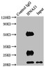 Immunoprecipitating IFNA21 in HEK293 whole cell lysate<br />
 Lane 1: Rabbit control IgG instead of CSB-PA011039EA01HU in HEK293 whole cell lysate.
 For western blotting, a HRP-conjugated Protein G antibody was used as the secondary antibody (1/2000) <br />
 Lane 2: CSB-PA011039EA01HU (8µg) + HEK293 whole cell lysate (500µg) <br />
 Lane 3: HEK293 whole cell lysate (10µg) <br />