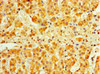 Immunohistochemistry of paraffin-embedded human adrenal gland tissue using CSB-PA011040LA01HU at dilution of 1:100