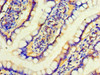 Immunohistochemistry of paraffin-embedded human small intestine tissue using CSB-PA011040LA01HU at dilution of 1:100