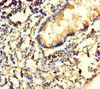 Immunohistochemistry of paraffin-embedded human appendix tissue using CSB-PA01115A0Rb at dilution of 1:100