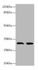 Western blot<br />
 All lanes: IL1B antibody at 2µg/ml<br />
 Lane 1: Recombinant Interleukin-1 beta protein 0.05µg<br />
 Lane 2: Recombinant Interleukin-1 beta protein 0.5µg<br />
 Secondary<br />
 Goat polyclonal to rabbit IgG at 1/10000 dilution<br />
 Predicted band size: 31 kDa<br />
 Observed band size: 31 kDa<br />