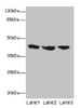 Western blot<br />
 All lanes: IL2RG antibody at 12µg/ml<br />
 Lane 1: Jurkat whole cell lysate<br />
 Lane 2: K562 whole cell lysate<br />
 Lane 3: HL60 whole cell lysate<br />
 Secondary<br />
 Goat polyclonal to rabbit IgG at 1/10000 dilution<br />
 Predicted band size: 43, 21 kDa<br />
 Observed band size: 43 kDa<br />