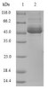 (Tris-Glycine gel) Discontinuous SDS-PAGE (reduced) with 5% enrichment gel and 15% separation gel.