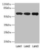 Western blot<br />
 All lanes: IMPDH2 antibody at 12µg/ml<br />
 Lane 1: Mouse heart tissue<br />
 Lane 2: A549 whole cell lysate<br />
 Lane 3: Hela whole cell lysate<br />
 Secondary<br />
 Goat polyclonal to rabbit IgG at 1/10000 dilution<br />
 Predicted band size: 56 kDa<br />
 Observed band size: 56 kDa<br />