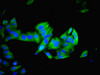 Immunofluorescent analysis of Hela cells using CSB-PA011701LA01HU at dilution of 1:100 and Alexa Fluor 488-congugated AffiniPure Goat Anti-Rabbit IgG (H+L)