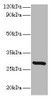 Western blot<br />
 All lanes: INMT antibody at 2µg/ml + Mouse lung tissue<br />
 Secondary<br />
 Goat polyclonal to rabbit lgG at 1/15000 dilution<br />
 Predicted band size: 29 kDa<br />
 Observed band size: 29 kDa<br />