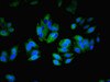 Immunofluorescent analysis of HepG2 cells using CSB-PA011875LA01HU at dilution of 1:100 and Alexa Fluor 488-congugated AffiniPure Goat Anti-Rabbit IgG (H+L)