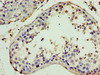 Immunohistochemistry of paraffin-embedded human testis tissue using CSB-PA011897YA01HU at dilution of 1:100