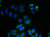 Immunofluorescent analysis of A549 cells using CSB-PA011903LA01HU at dilution of 1:100 and Alexa Fluor 488-congugated AffiniPure Goat Anti-Rabbit IgG (H+L)
