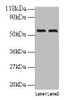 Western blot<br />
 All lanes: IMPDH2 antibody at 2µg/ml<br />
 Lane 1: EC109 whole cell lysate<br />
 Lane 2: 293T whole cell lysate<br />
 Secondary<br />
 Goat polyclonal to rabbit IgG at 1/15000 dilution<br />
 Predicted band size: 56 kDa<br />
 Observed band size: 56 kDa<br />