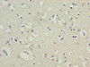 Immunohistochemistry of paraffin-embedded human brain tissue using CSB-PA012022LA01HU at dilution of 1:100