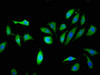 Immunofluorescent analysis of Hela cells using CSB-PA012421LA01HU at dilution of 1:100 and Alexa Fluor 488-congugated AffiniPure Goat Anti-Rabbit IgG (H+L)