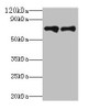 Western blot<br />
 All lanes: Klkb1 antibody at 2µg/ml<br />
 Lane 1: Hela whole cell lysate<br />
 Lane 2: Rat brain tissue<br />
 Secondary<br />
 Goat polyclonal to rabbit IgG at 1/10000 dilution<br />
 Predicted band size: 72 kDa<br />
 Observed band size: 72 kDa<br />