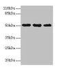Western blot<br />
 All lanes: KRT38 antibody at 2µg/ml<br />
 Lane 1: MCF-7 whole cell lysate<br />
 Lane 2: Hela whole cell lysate<br />
 Lane 3: HepG2 whole cell lysate<br />
 Secondary<br />
 Goat polyclonal to rabbit IgG at 1/10000 dilution<br />
 Predicted band size: 51 kDa<br />
 Observed band size: 51 kDa<br />