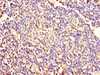 Immunohistochemistry of paraffin-embedded human tonsil tissue using CSB-PA012556LA01HU at dilution of 1:100