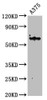 Western Blot<br />
 Positive WB detected in: A375 whole cell lysate<br />
 All lanes: KRT6A antibody at 4.6µg/ml<br />
 Secondary<br />
 Goat polyclonal to rabbit IgG at 1/50000 dilution<br />
 Predicted band size: 61 kDa<br />
 Observed band size: 61 kDa<br />