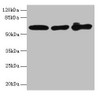 Western blot<br />
 All lanes: KRT6A antibody at 4µg/ml<br />
 Lane 1: A431 whole cell lysate<br />
 Lane 2: K562 whole cell lysate<br />
 Lane 3: MCF-7 whole cell lysate<br />
 Secondary<br />
 Goat polyclonal to rabbit IgG at 1/10000 dilution<br />
 Predicted band size: 61 kDa<br />
 Observed band size: 61 kDa<br />