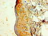 Immunohistochemistry of paraffin-embedded human skin tissue using CSB-PA012561LA01HU at dilution of 1:100