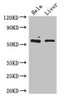 Western Blot<br />
 Positive WB detected in: Hela whole cell lysate, Mouse liver tissue<br />
 All lanes: KRT81 antibody at 5µg/ml<br />
 Secondary<br />
 Goat polyclonal to rabbit IgG at 1/50000 dilution<br />
 Predicted band size: 55 kDa<br />
 Observed band size: 55 kDa<br />