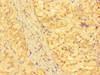Immunohistochemistry of paraffin-embedded human adrenal gland tissue using CSB-PA012641LA01HU at dilution of 1:100