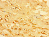 Immunohistochemistry of paraffin-embedded human placenta tissue using CSB-PA012641LA01HU at dilution of 1:100