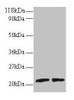 Western blot<br />
 All lanes: ARL2 antibody at 2µg/ml<br />
 Lane 1: EC109 whole cell lysate<br />
 Lane 2: 293T whole cell lysate<br />
 Secondary<br />
 Goat polyclonal to rabbit IgG at 1/15000 dilution<br />
 Predicted band size: 21, 19 kDa<br />
 Observed band size: 21 kDa<br />