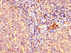 IHC image of CSB-PA012719LA01HU diluted at 1:200 and staining in paraffin-embedded human tonsil tissue performed on a Leica BondTM system. After dewaxing and hydration, antigen retrieval was mediated by high pressure in a citrate buffer (pH 6.0) . Section was blocked with 10% normal goat serum 30min at RT. Then primary antibody (1% BSA) was incubated at 4°C overnight. The primary is detected by a biotinylated secondary antibody and visualized using an HRP conjugated SP system.
