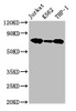 Western Blot<br />
 Positive WB detected in: Jurkat whole cell lysate, K562 whole cell lysate, THP-1 whole cell lysate<br />
 All lanes: LCP1 antibody at 2.6µg/ml<br />
 Secondary<br />
 Goat polyclonal to rabbit IgG at 1/50000 dilution<br />
 Predicted band size: 71, 22 kDa<br />
 Observed band size: 71 kDa<br />