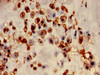 Immunohistochemistry of paraffin-embedded human placenta tissue using CSB-PA012887YA01HU at dilution of 1:100