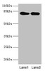 Western blot<br />
 All lanes: LHCGR antibody at 2µg/ml<br />
 Lane 1: Mouse brain tissue<br />
 Lane 2: Mouse kidney tissue<br />
 Secondary<br />
 Goat polyclonal to rabbit IgG at 1/10000 dilution<br />
 Predicted band size: 79, 72 kDa<br />
 Observed band size: 79 kDa<br />