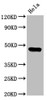 Western Blot<br />
 Positive WB detected in: Hela whole cell lysate<br />
 All lanes: CSNK1E antibody at 3.2µg/ml<br />
 Secondary<br />
 Goat polyclonal to rabbit IgG at 1/50000 dilution<br />
 Predicted band size: 48 kDa<br />
 Observed band size: 48 kDa<br />