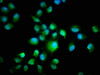 Immunofluorescence staining of Hela cells with CSB-PA01319A0Rb at 1:266, counter-stained with DAPI. The cells were fixed in 4% formaldehyde, permeabilized using 0.2% Triton X-100 and blocked in 10% normal Goat Serum. The cells were then incubated with the antibody overnight at 4°C. The secondary antibody was Alexa Fluor 488-congugated AffiniPure Goat Anti-Rabbit IgG (H+L) .