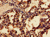 Immunohistochemistry of paraffin-embedded human lung tissue using CSB-PA013334LA01HU at dilution of 1:100