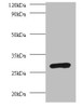 Western blot<br />
 All lanes: PSMA7 antibody at 2µg/ml + 293T whole cell lysate<br />
 Secondary<br />
 Goat polyclonal to rabbit IgG at 1/10000 dilution<br />
 Predicted band size: 28, 21, 17 kDa<br />
 Observed band size: 28 kDa<br />