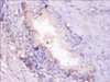 Immunohistochemistry of paraffin-embedded human prostate tissue using CSB-PA01335A0Rb at dilution of 1:100
