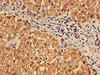 Immunohistochemistry of paraffin-embedded human liver tissue using CSB-PA01335A0Rb at dilution of 1:100