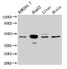 Western Blot<br />
 Positive WB detected in: RAW264.7 whole cell lysate, HepG2 whole cell lysate, Rat liver tissue, Mouse brain tissue<br />
 All lanes: Map2k4 antibody at 3.2µg/ml<br />
 Secondary<br />
 Goat polyclonal to rabbit IgG at 1/50000 dilution<br />
 Predicted band size: 45 kDa<br />
 Observed band size: 45 kDa<br />